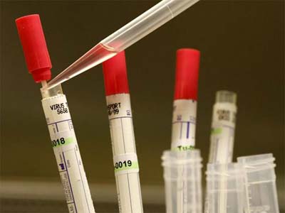 基因检测：理想丰满 现实骨感